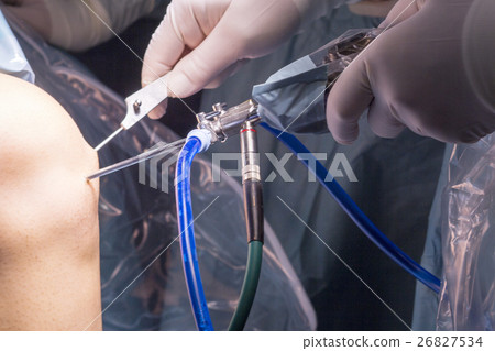 Surgical operation knee surgery Surgical operation knee surgery 26827534