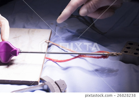 Knee tendon ligament surgery Knee tendon ligament surgery 26828238
