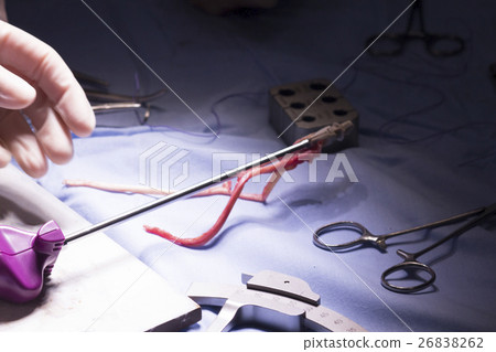 Knee tendon ligament surgery Knee tendon ligament surgery 26838262