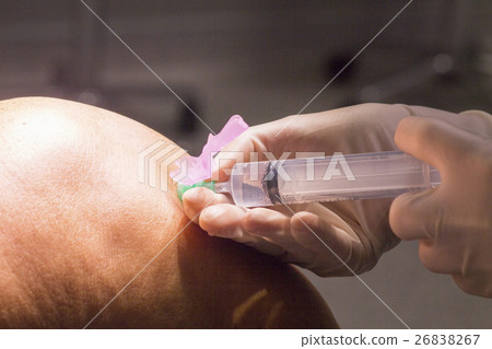 Anaesthetic injection in surgery Anaesthetic injection in surgery 26838267