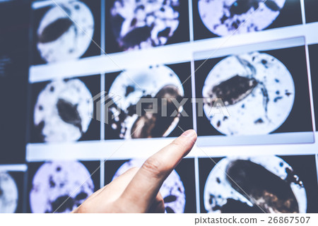 Daphnia 26867507