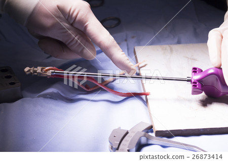 Knee tendon ligament surgery 26873414