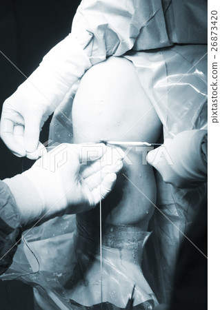 Surgical operation knee surgery Surgical operation knee surgery 26873420