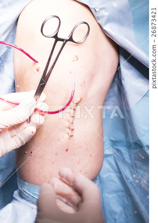 Surgical operation knee surgery 26873421