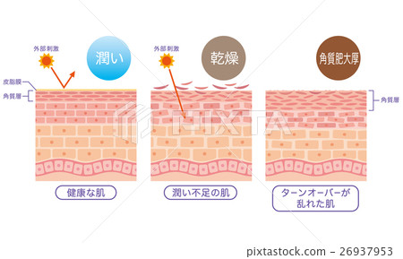 皮膚健康 皮膚水分不足皮膚營養不良 插圖素材 圖庫