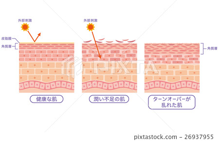 皮膚健康 皮膚水分不足皮膚營養不良 插圖素材 圖庫