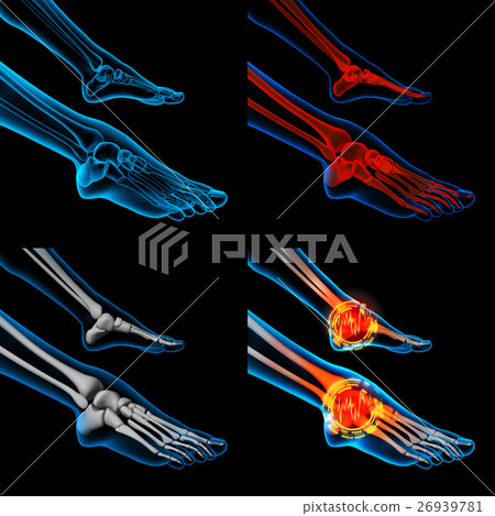 3D rendering human foot pain of the skeleton foot 26939781