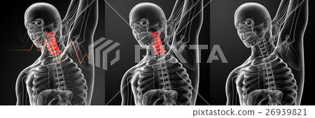 3d rendering illustration - pain neck 26939821