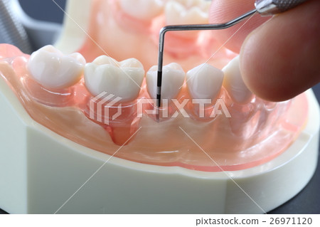 牙周病篩查（輕度） 26971120