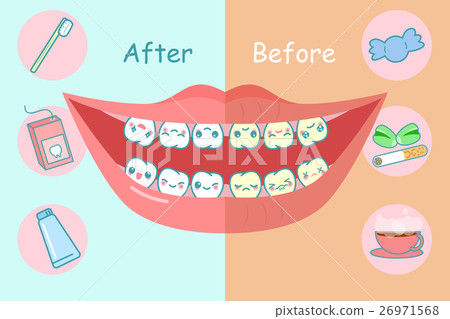 Before and after teeth 26971568