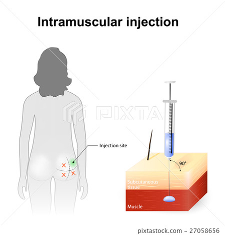 intramuscular injection stock illustration