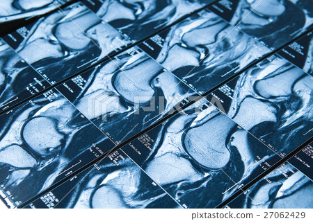 MRI image of knee joint leg MRI image of knee joint leg 27062429