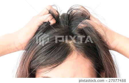 Woman serious hair loss problem for health 27077488