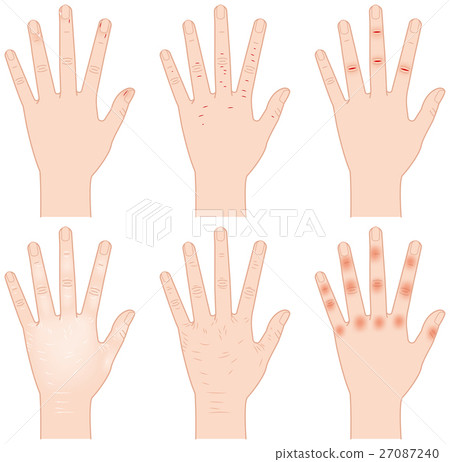 Rough hand 27087240