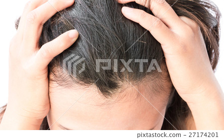 Woman serious hair loss problem Woman serious hair loss problem 27174201