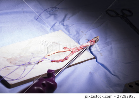 Knee tendon ligament surgery Knee tendon ligament surgery 27282953