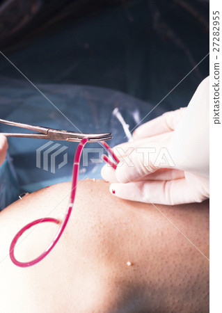 Surgical operation knee surgery Surgical operation knee surgery 27282955
