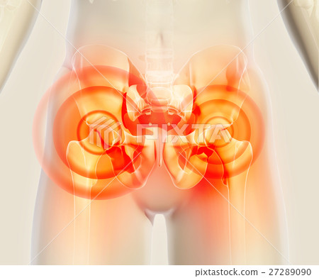 Hip painful skeleton x-ray, 3D illustration. 27289090