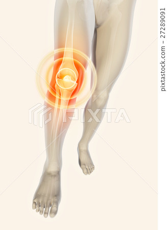 Knee painful - skeleton x-ray. Knee painful - skeleton x-ray. 27289091