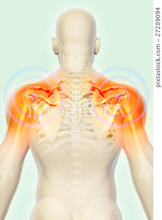 Shoulder painful skeleton x-ray, 3D illustration. 27289094