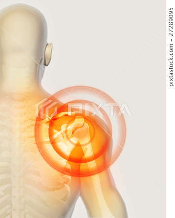Shoulder painful skeleton x-ray, 3D illustration. 27289095