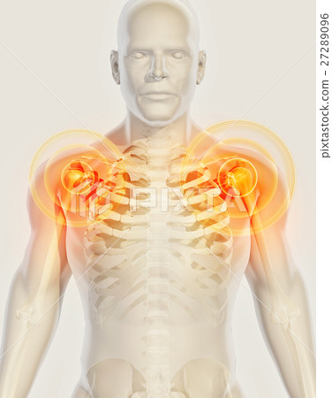 Shoulder painful skeleton x-ray, 3D illustration. 27289096