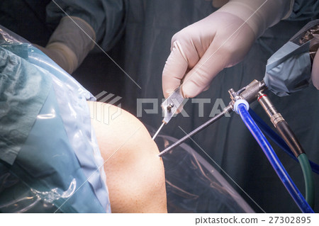 Surgical operation knee surgery Surgical operation knee surgery 27302895