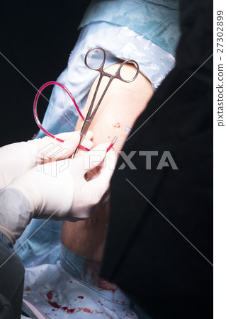 Surgical operation knee surgery Surgical operation knee surgery 27302899