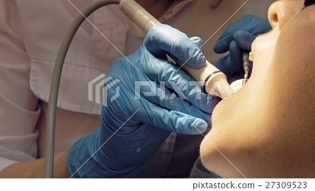 Woman ultrasonic tooth plaque odontolith removing 27309523