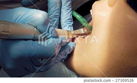Woman at the dentist medical clinic for treatment 27309526