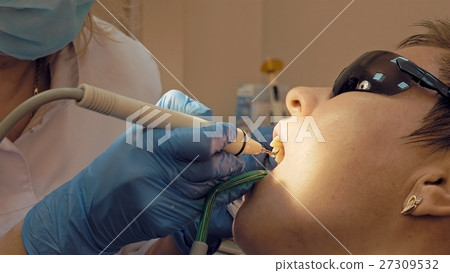 Woman ultrasonic tooth plaque odontolith removing Woman ultrasonic tooth plaque odontolith removing 27309532