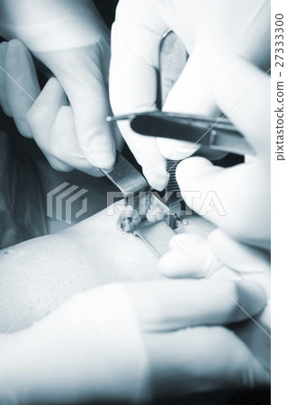 Surgical operation knee surgery Surgical operation knee surgery 27333300