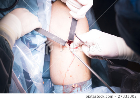 Surgical operation knee surgery Surgical operation knee surgery 27333302