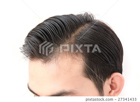 Young man worry hair loss problem 27341433