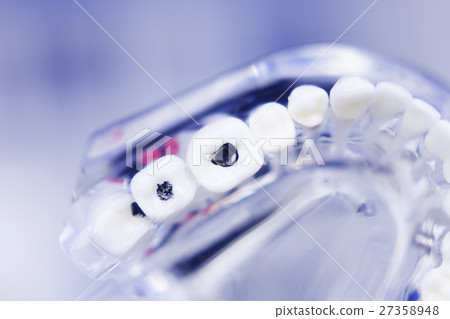 Dentists dental teeth model 27358948