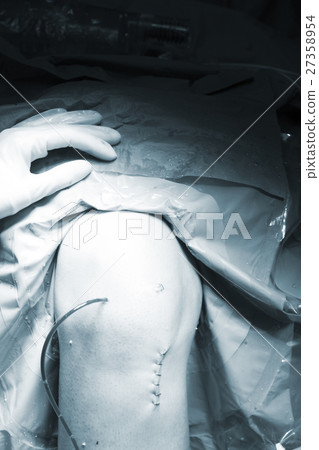 Surgical operation knee surgery Surgical operation knee surgery 27358954