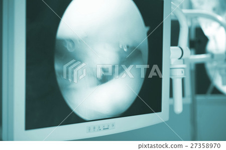Knee surgery operation screen Knee surgery operation screen 27358970