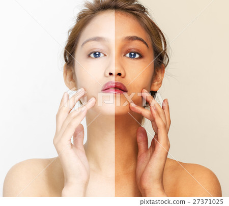 Sunburn image 27371025