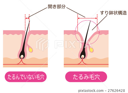 Pore Section Opened Pore 27626428
