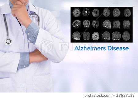 Alzheimers Disease concept , Brain degenerative  27657182