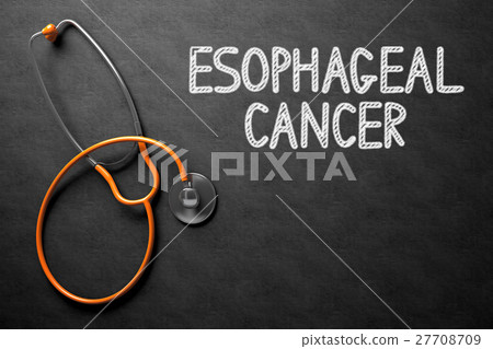 Chalkboard with Esophageal Cancer. 3D Illustration 27708709