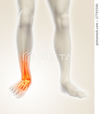 Ankle painful - skeleton x-ray. 27793500