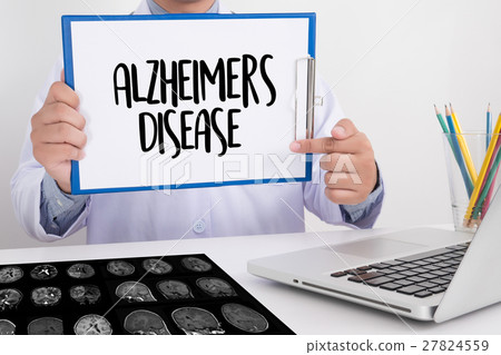 Alzheimers Disease concept , Brain degenerative 27824559