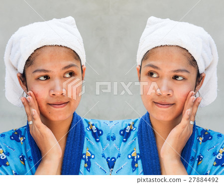 Before and after cosmetic operation,removal of acne on gray back 27884492