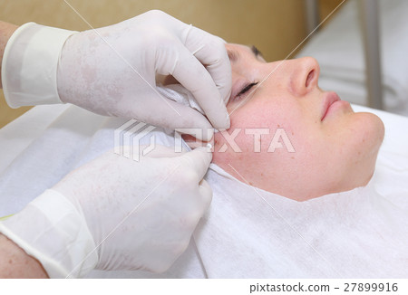 Procedure of face lifting surgery. 27899916