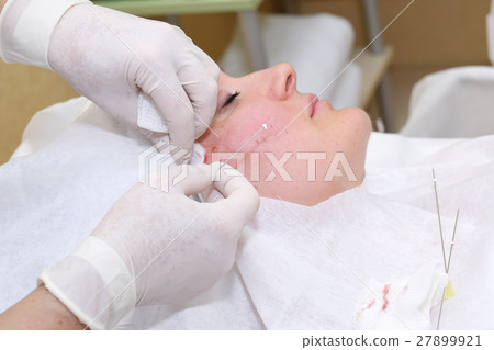 Procedure of face lifting surgery. 27899921