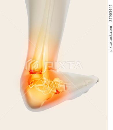 Ankle painful - skeleton x-ray. 27905445
