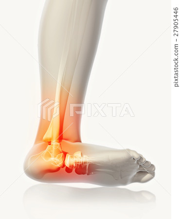 Ankle painful - skeleton x-ray. 27905446