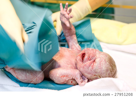 Newborn child seconds and minutes after birth. Newborn child seconds and minutes after birth. 27951208