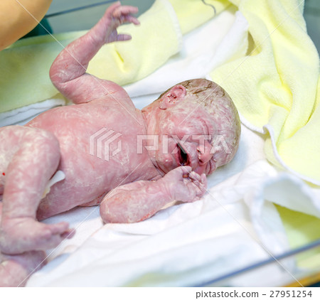 Newborn child seconds and minutes after birth. Newborn child seconds and minutes after birth. 27951254